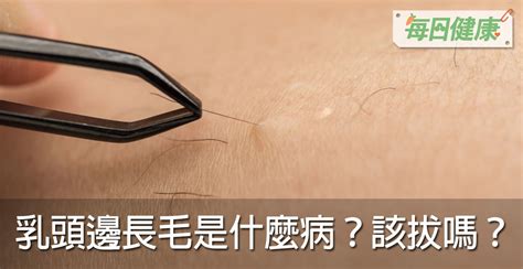 胸部長一根毛|乳頭邊長了毛，是什麼病？該不該拔？讓名醫一次解釋給您聽｜每